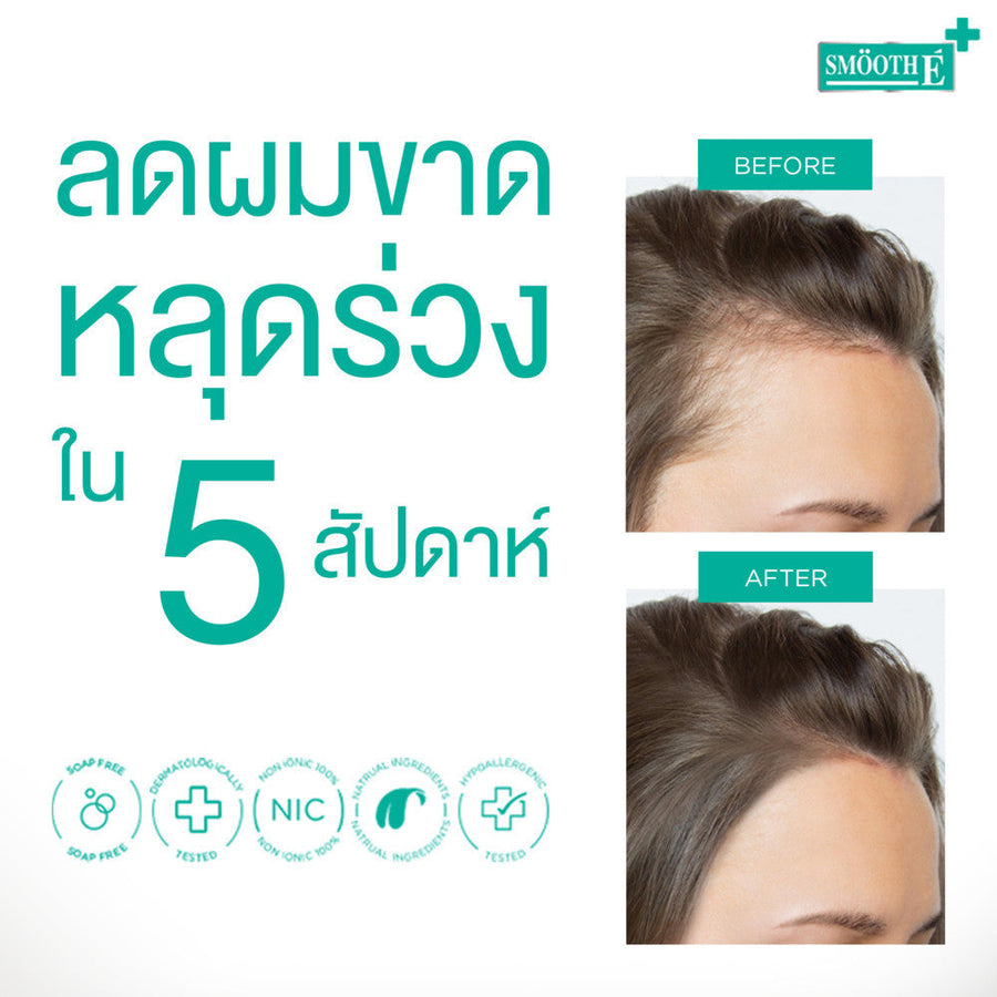 (Deal Duo) Smooth E Anti Hair Loss Thickening Set Free Smooth E Acne Hydrogel 7 g.