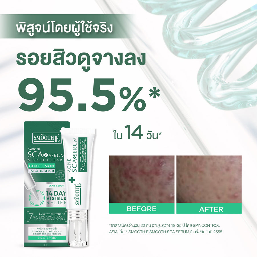 Smooth E Acne Scar Serum