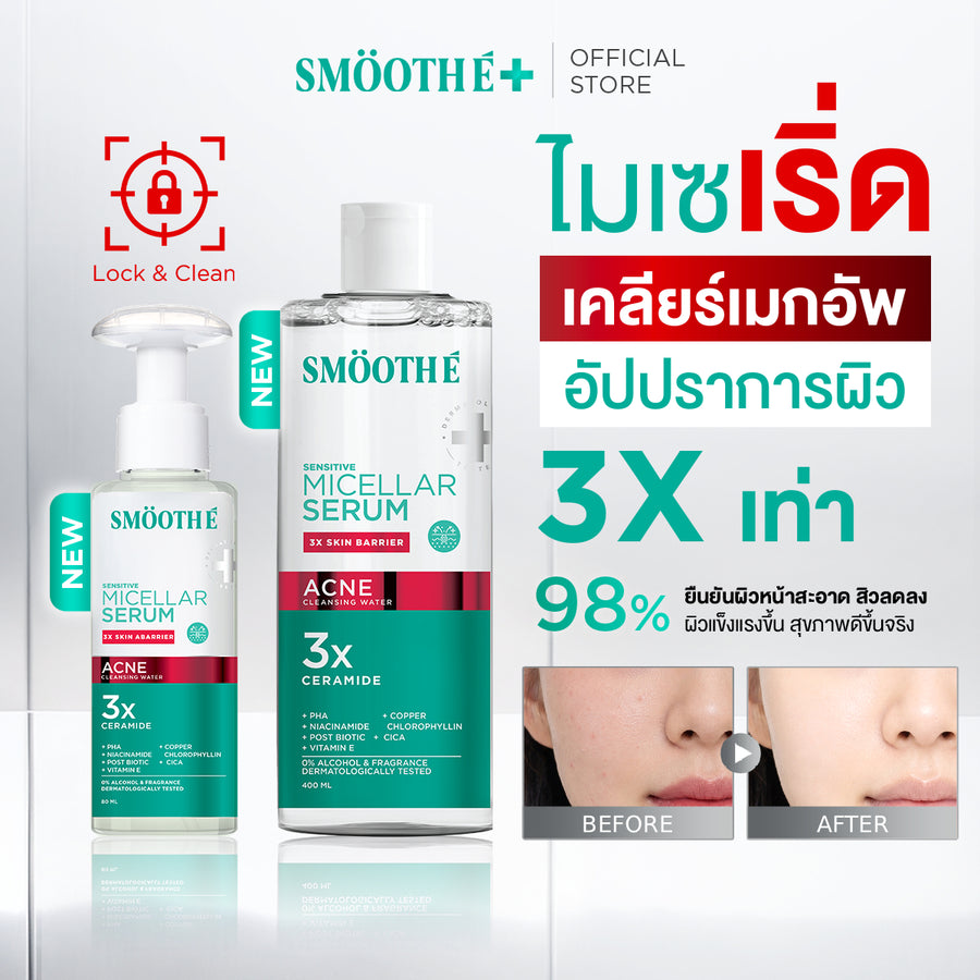 [Pre-Order] SMOOTHE MICELLAR SERUM ACNE CLEANSING WATER