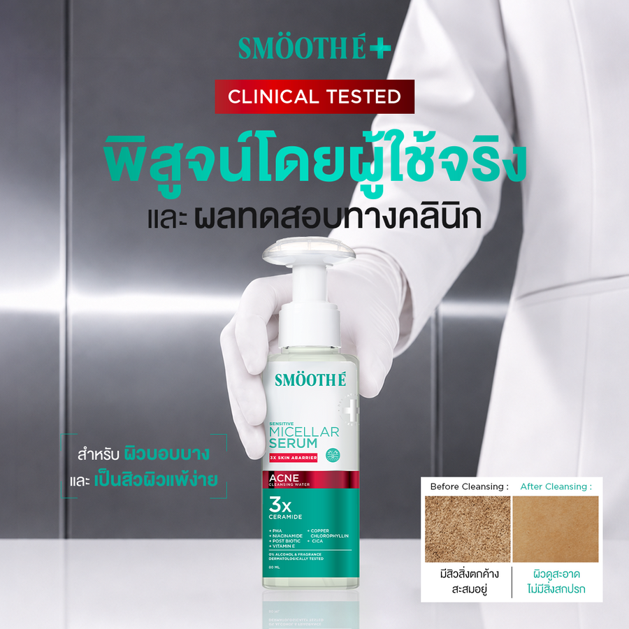 [Pre-Order] SMOOTHE MICELLAR SERUM ACNE CLEANSING WATER