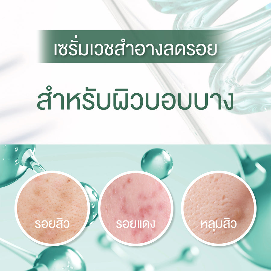 Smooth E Acne Scar Serum