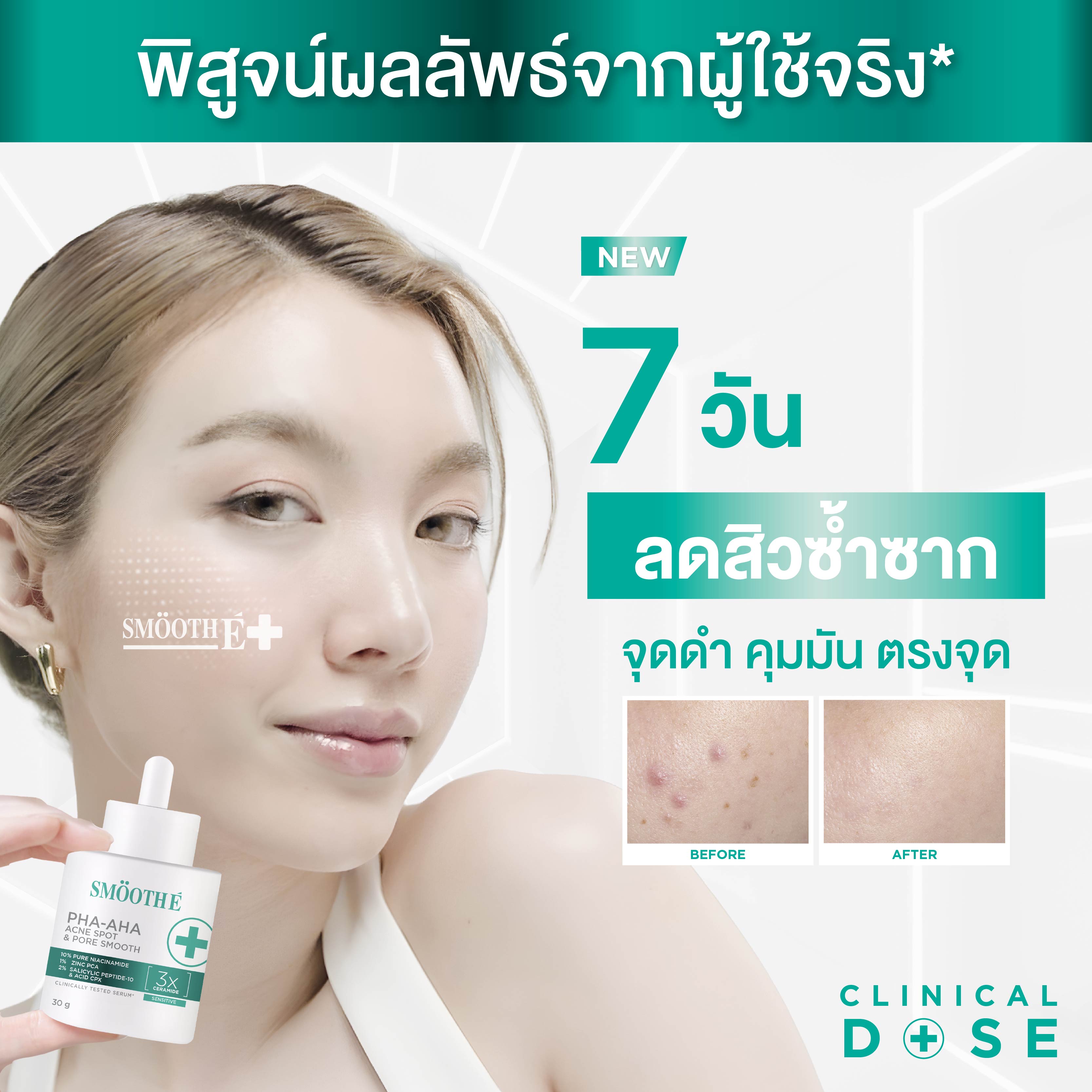 SMOOTH E PHA-AHA ACNE SPOT AND PORE SMOOTH 30 G.