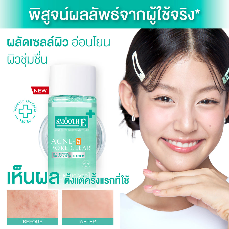 Smooth E Acne-5 Pore Clear Whitening Toner