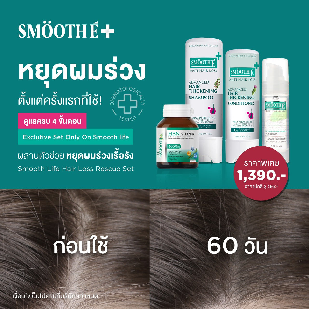 [Exclusive Set] Smooth Life Hair Loss Rescue Set